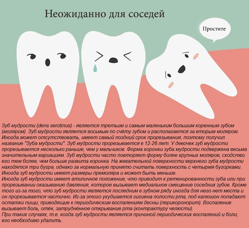 Зубы мудрости где расположены и какие по счету у человека фото